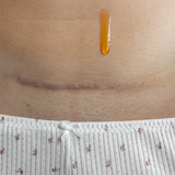 Unscented Belly, Body & Scar Oleogel