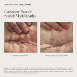 Unscented Belly, Body & Scar Oleogel