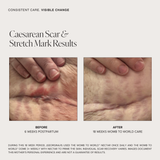 Unscented Belly, Body & Scar Oleogel