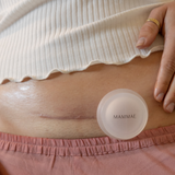 Medical Grade C-Section Scar Cupping Device